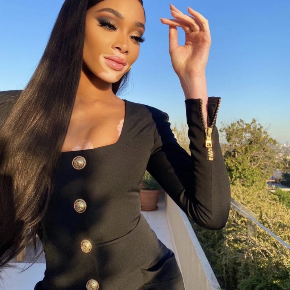 ويني هارلو تستمتع بأجواء الخريف الصباحية بإطلالتها الأنيقة