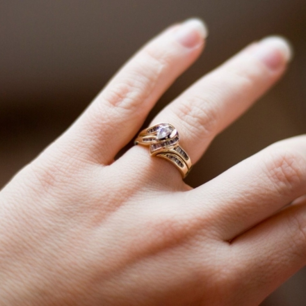 كلب ابتلع خاتم زواج!