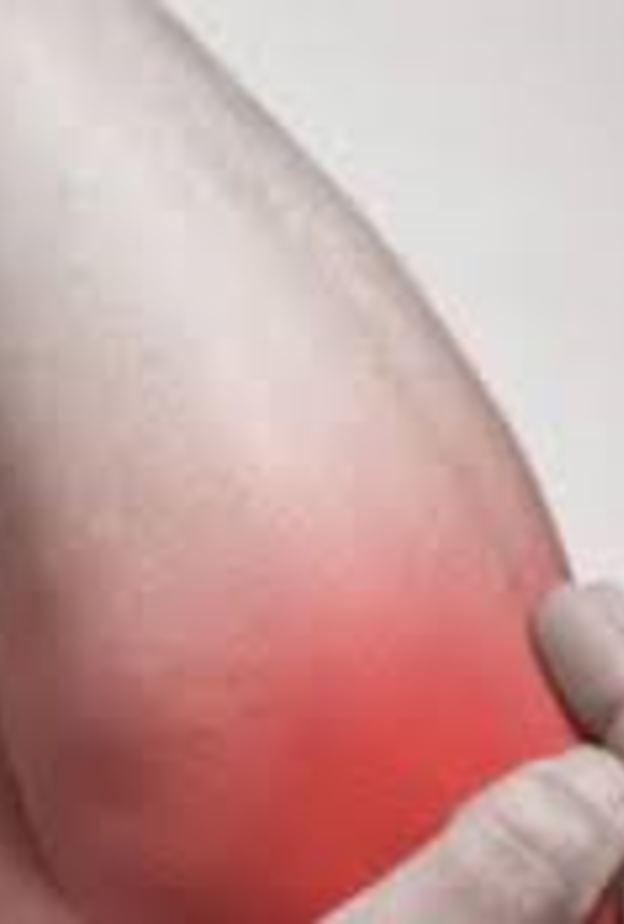  آلام المفاصل من أعراض سرطان العظام