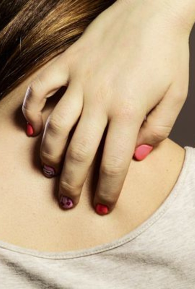  الحزام الناري يسبب آلام و حكة في الجلد