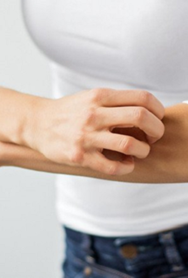 الحكة أبرز أعراض مرض الصدفية