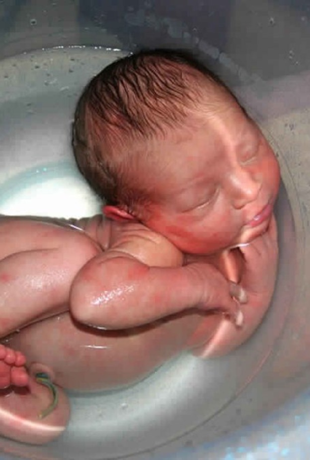 شروط الولادة تحت الماء وما هي فوائدها ومخاطرها