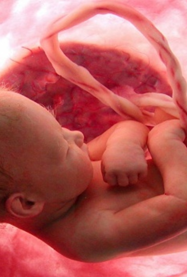 اسباب امراض قلب الاطفال اثناء الحمل هل يتم علاجها