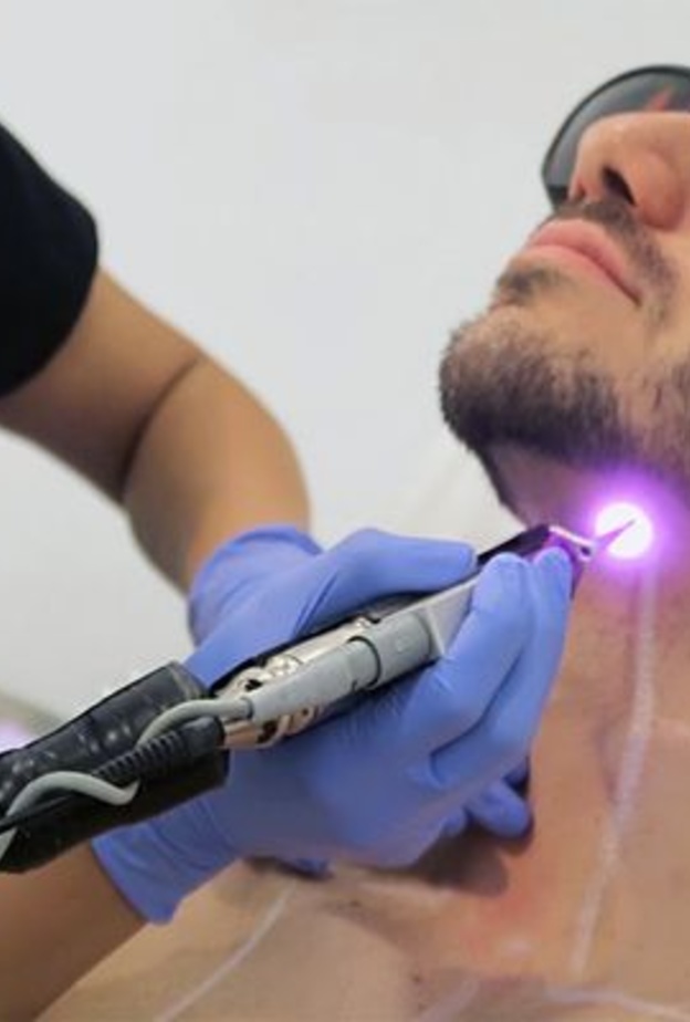 تحديد من الذقن بالليزر من عمليات التجميل المفضلة لدى الرجال