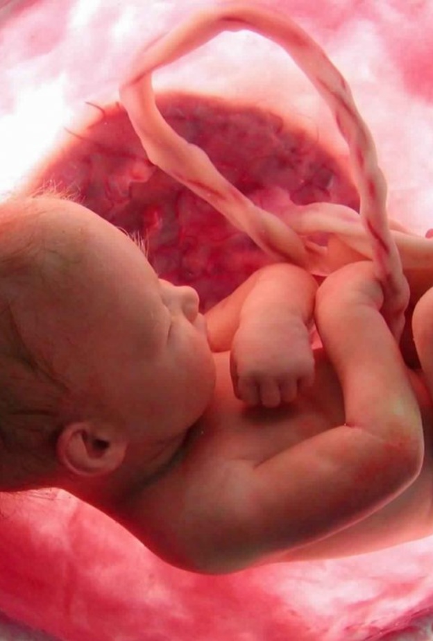 اسباب تشوه الاجنة وانواعها وطرق الوقاية منها