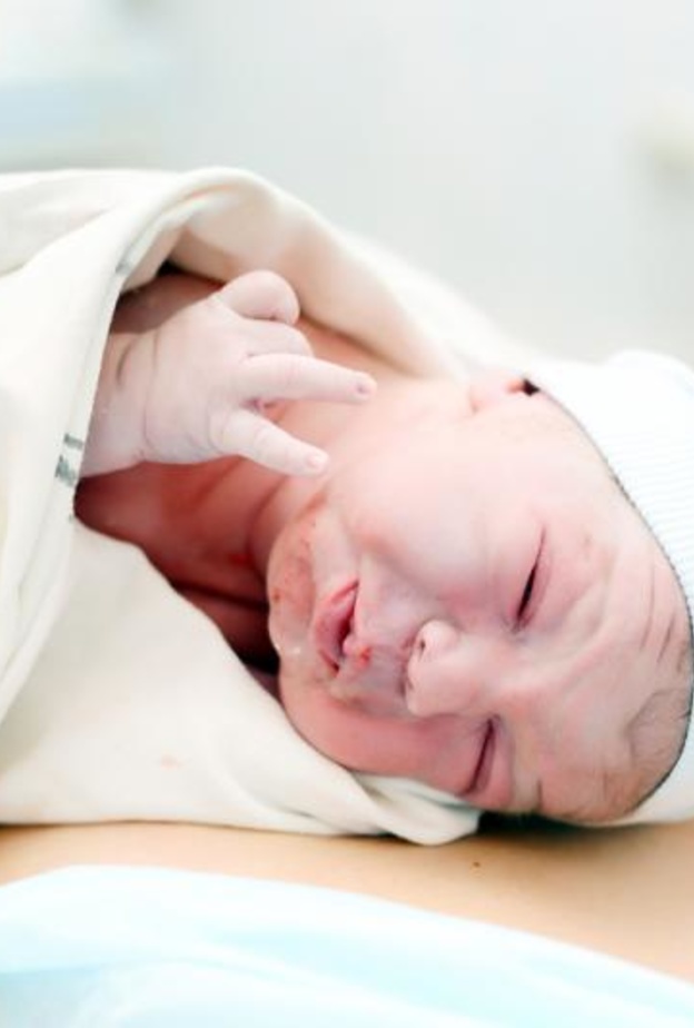 ولادة طفل حامل في شقيقه التوأم