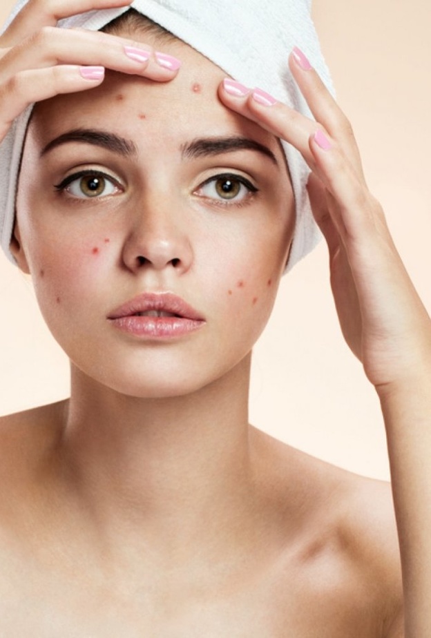 عالجي حب الشباب بالصودا والماء