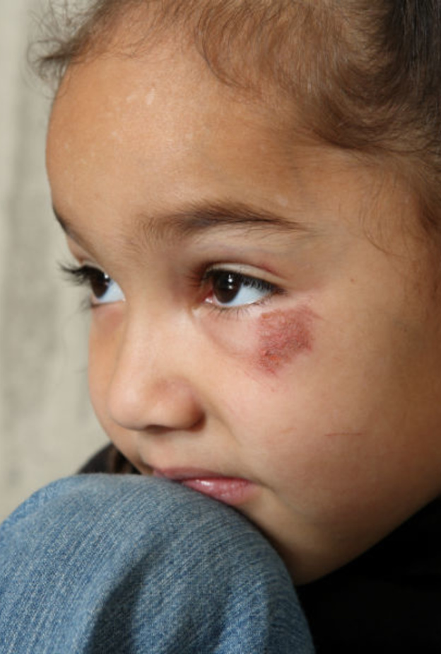 ضرب الأطفال يعلمهم أن الأخطاء شيء ممكن.