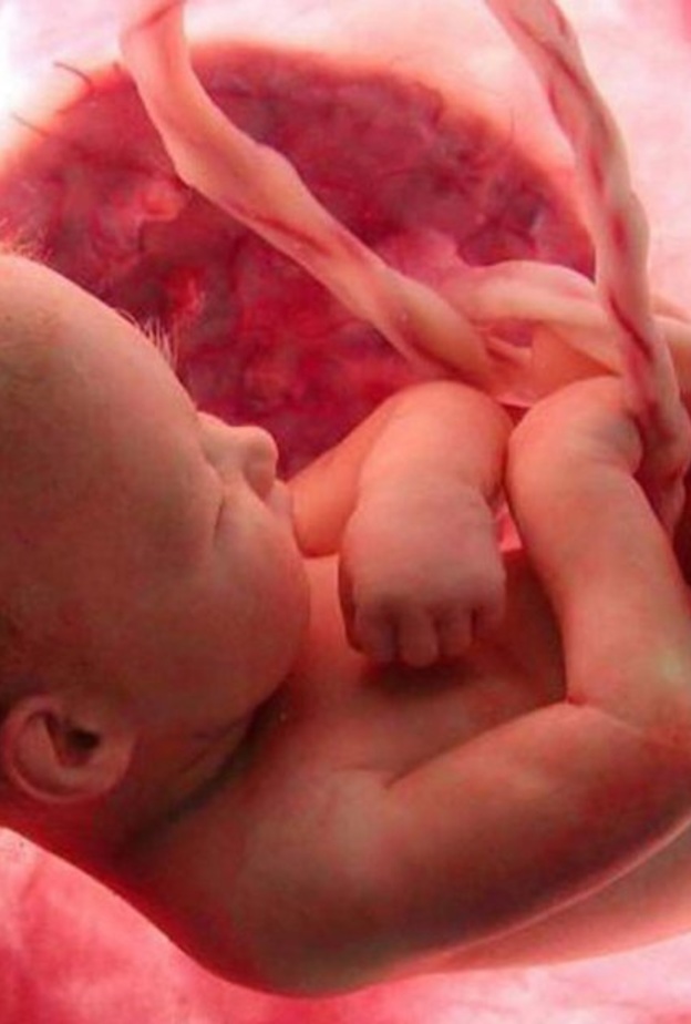 التقزم عند الاطفال هو صغر حجم الأطراف عند الطفل 