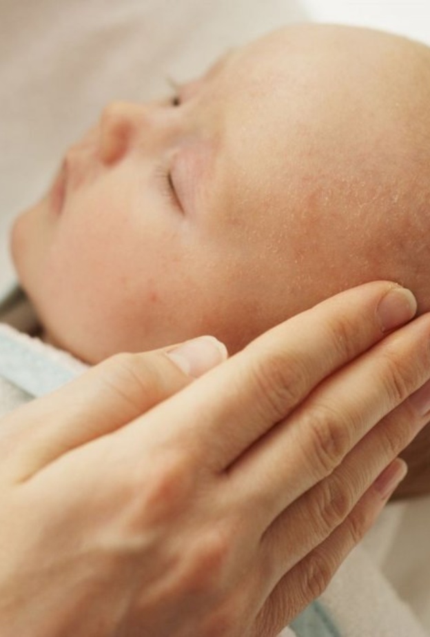 اسباب قشرة الشعر عند الاطفال