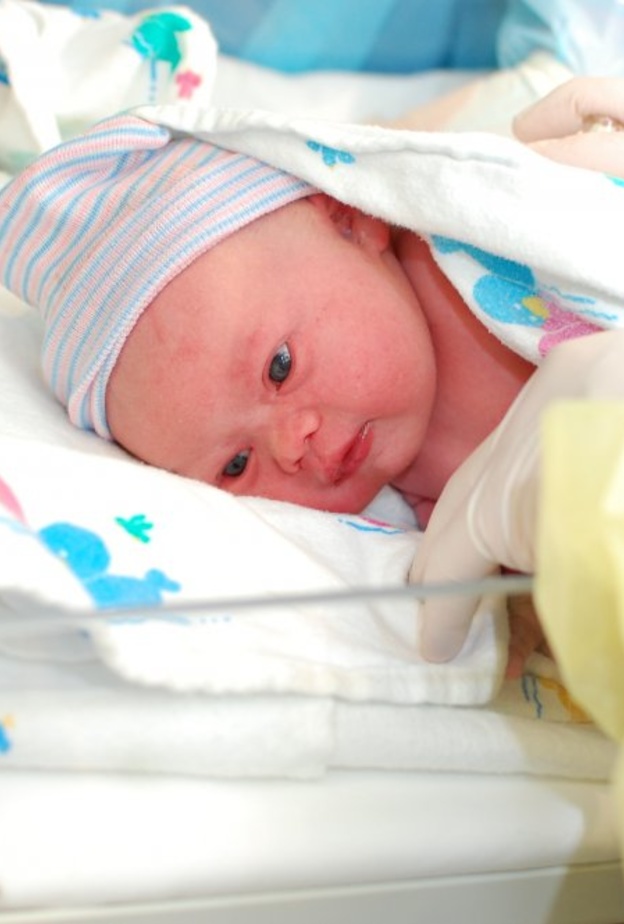 ملامح الوجه توضح اعراض متلازمة داون عند حديثي الولادة