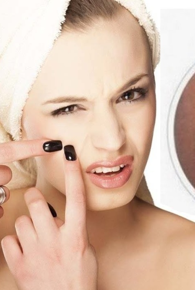 عقمي اصابعك قبل الضغط على الرؤوس السوداء