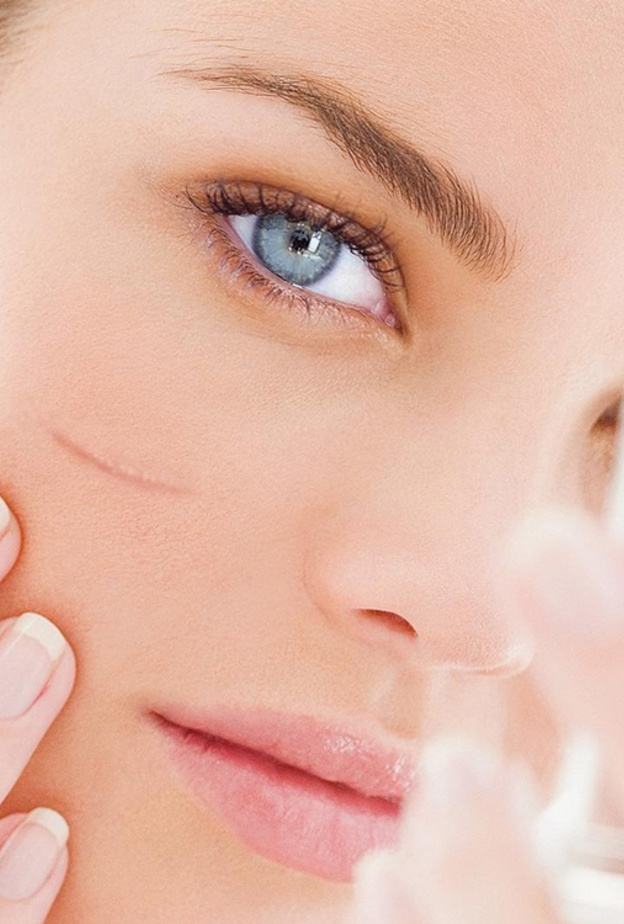 جربي هذه الوصفات الطبيعية للتخلص من آثار الجروح