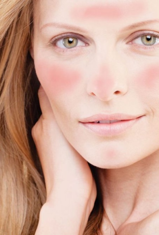 يفضل عدم حك الجلد أثنا حساسية الجلد