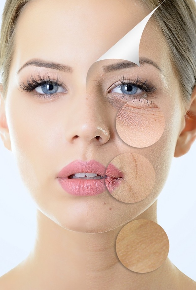 الأمراض الجلدية المرتبطة بالعيد