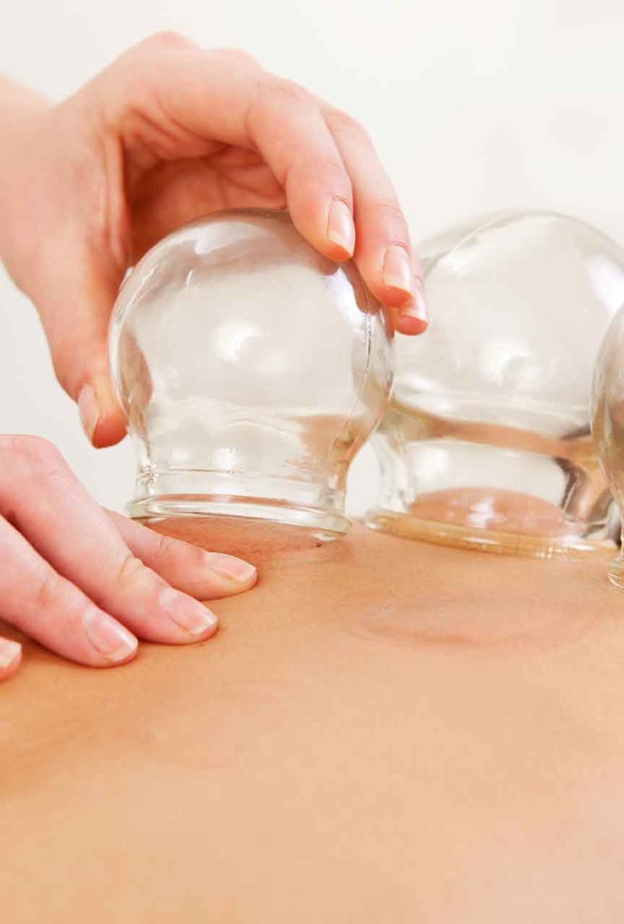 الحجامة يعتبرها الامريكيون من الطب البديل