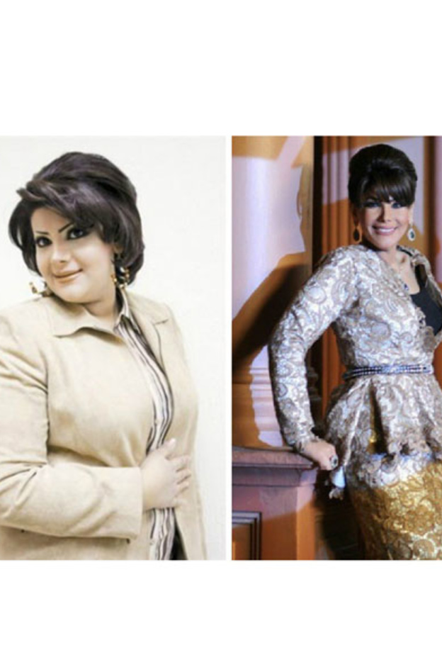  الهام الفضالة قبل وبعد خسارة الوزن