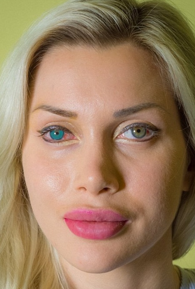 بيكسي فوكس اجرت جراحة لتغيير لون العيون