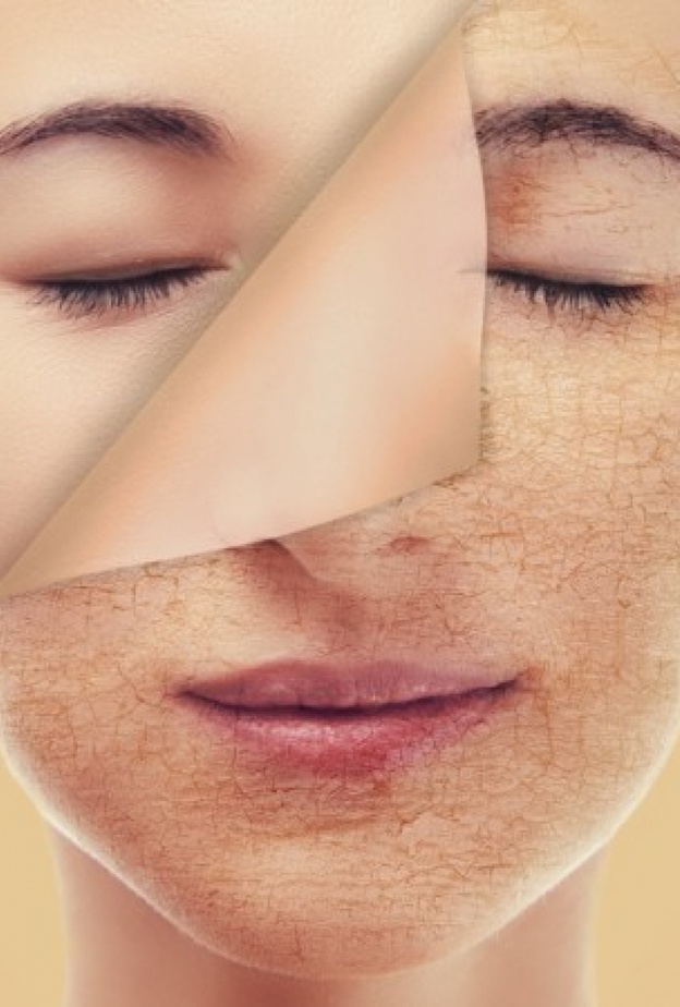 تخلصي من بشرتك الجافة بالعناية الدائمة