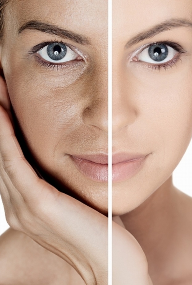 تخلصي من مشاكل البشرة و الهالات السوداء مع زيت اللوز 