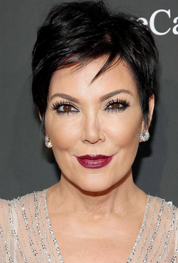 تشوه شفاه كريس