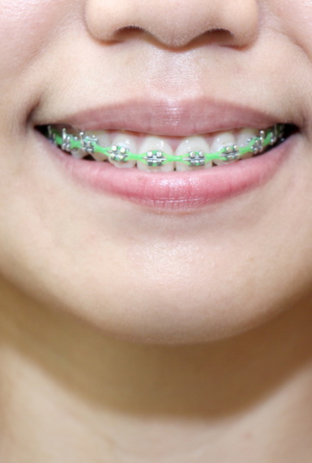 عيادات الاسنان تحرص على جلب أحدث الأجهزة