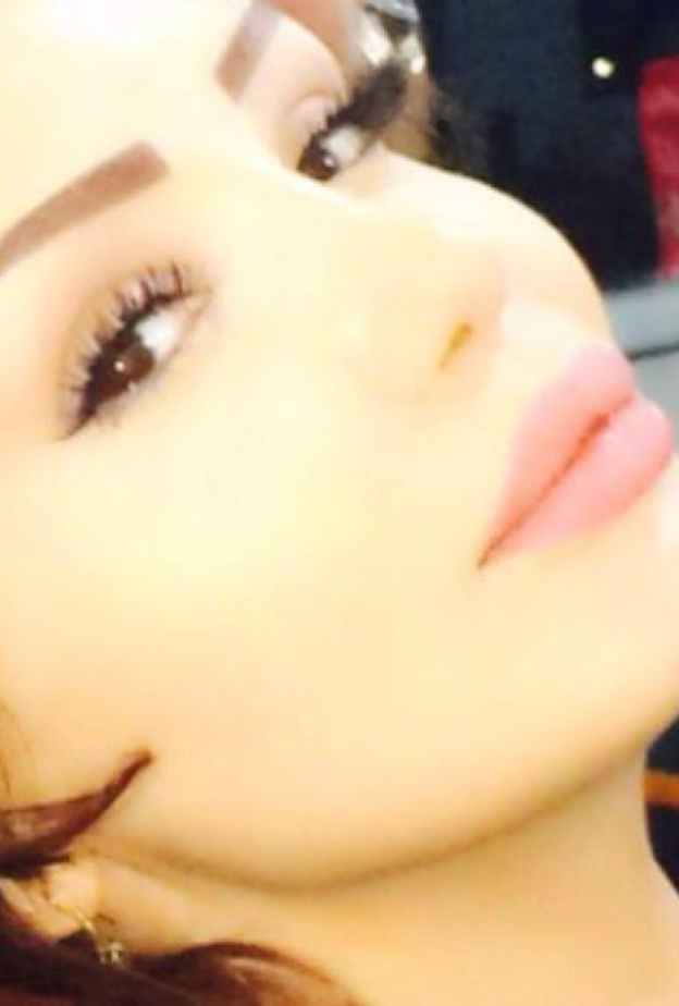 دينا هارون تعاني من التهاب رئوي حاد