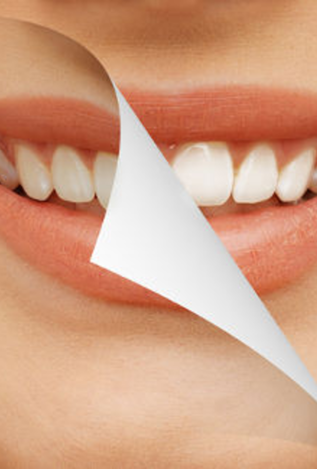 الحفاظ على نظافة الأسنان يحميها من تغير اللون