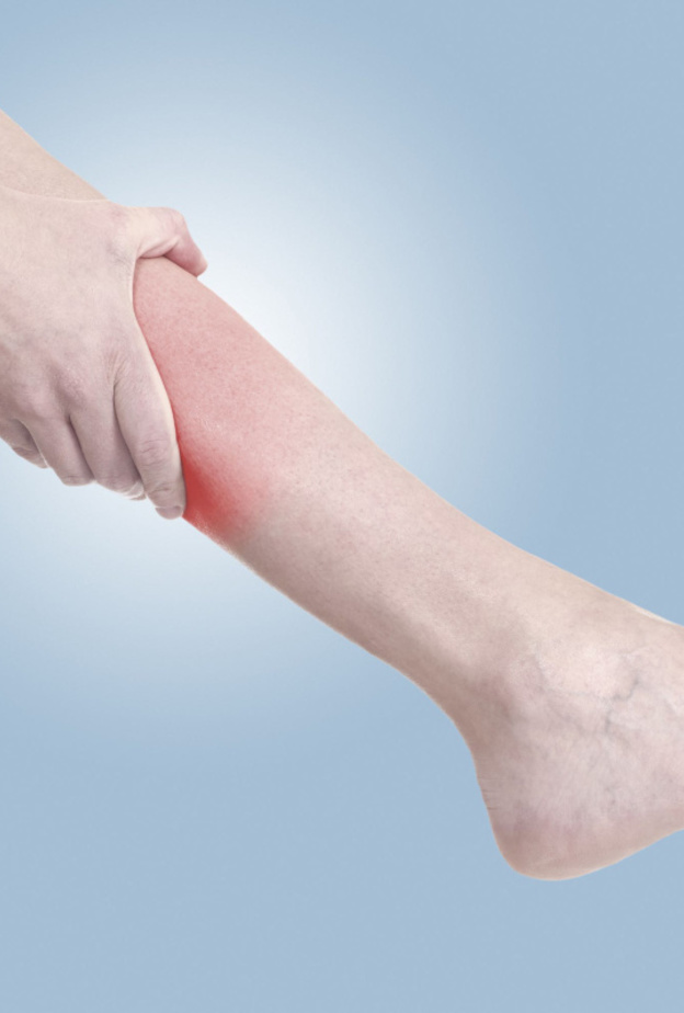 مرض الروماتيزم يسبب ألم الساق