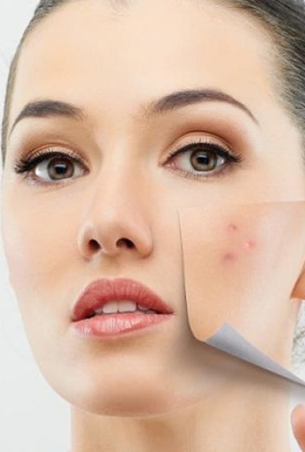  البثور اشاره لنقص فيتامين أ و فيتامين دال