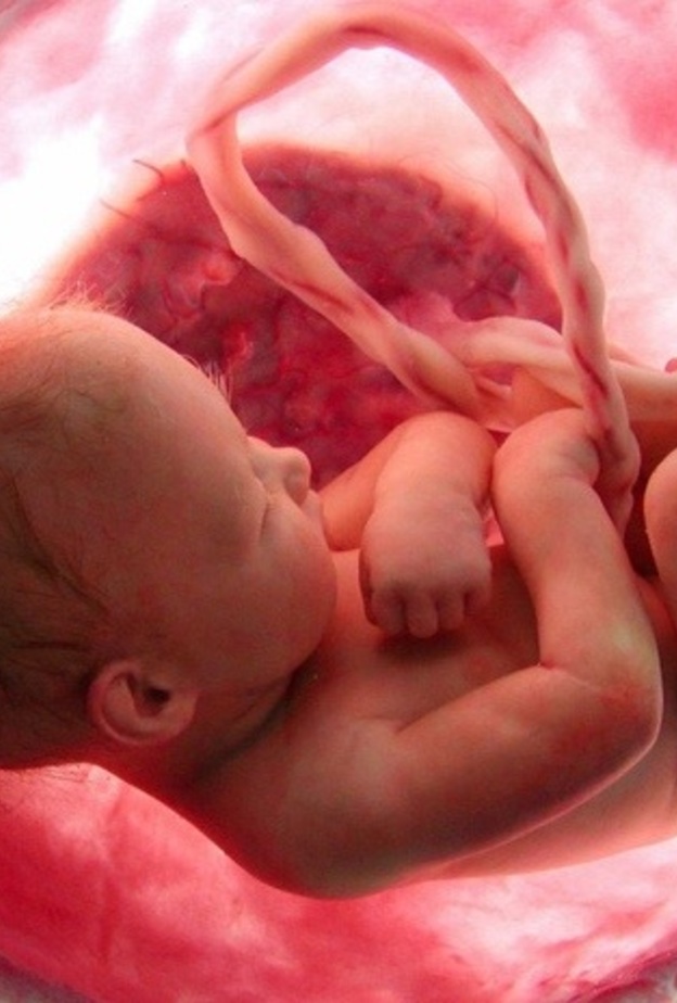 شاهد بالفيديو جنين يخرج من رحم امه بالكيس المشيمي