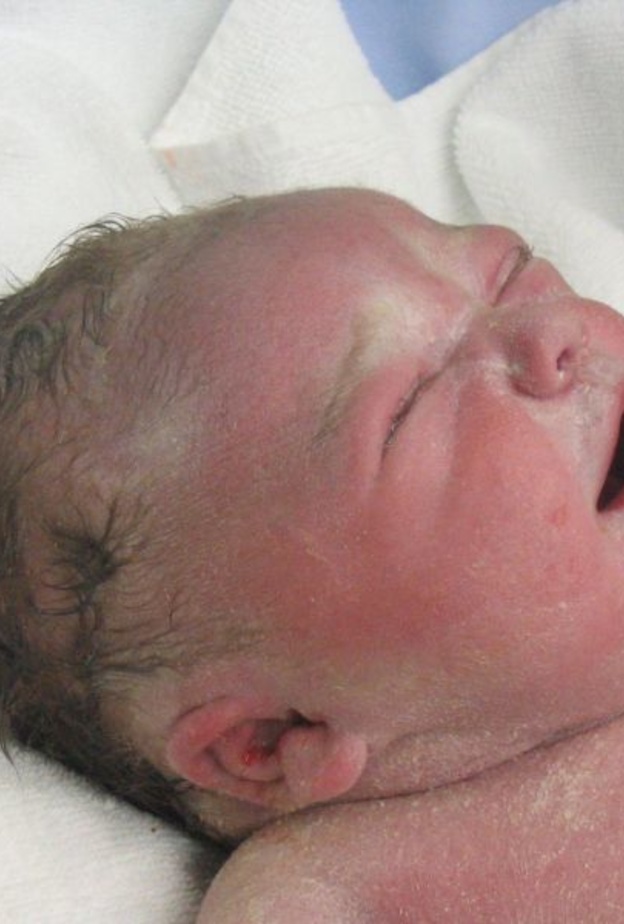 ضرب الطفل على ظهره بعد الولادة  