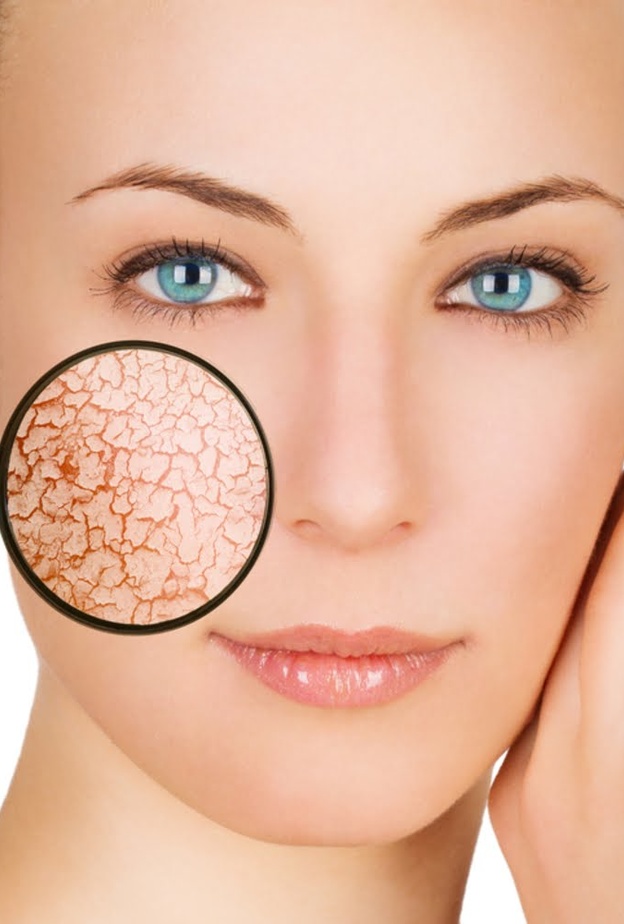 فصل الشتاء يفاقم مشكلة جفاف البشرة