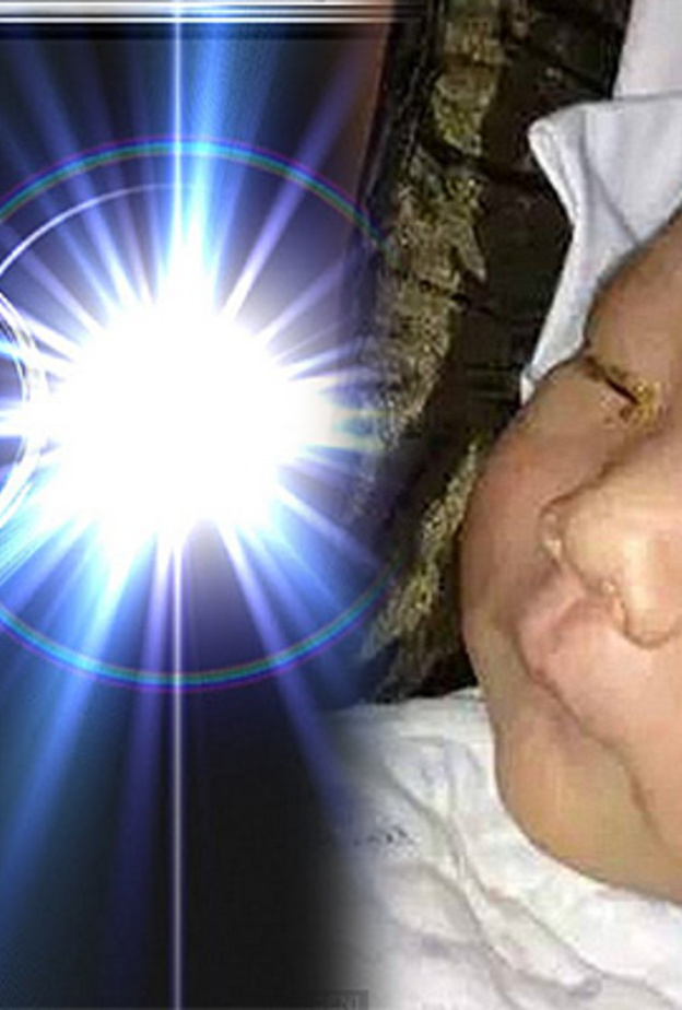 رضيع يصاب بعمى كامل في عينه بسبب ضوء فلاش الكاميرا!