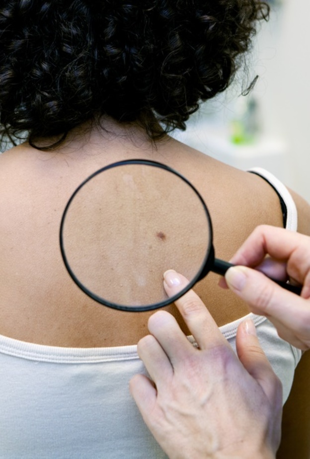 ما زال العلاج المناعي لسرطان الجلد غير نافع بالمطلق