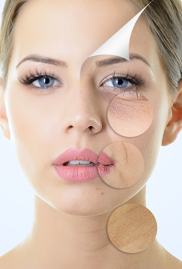 مشاكل البشرة الجافة اكبر من مشاكل اي نوع بشرة اخرى