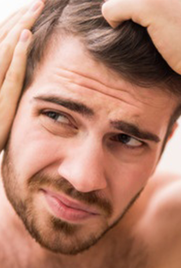 معلومات هامة عن الصلع عند الرجال