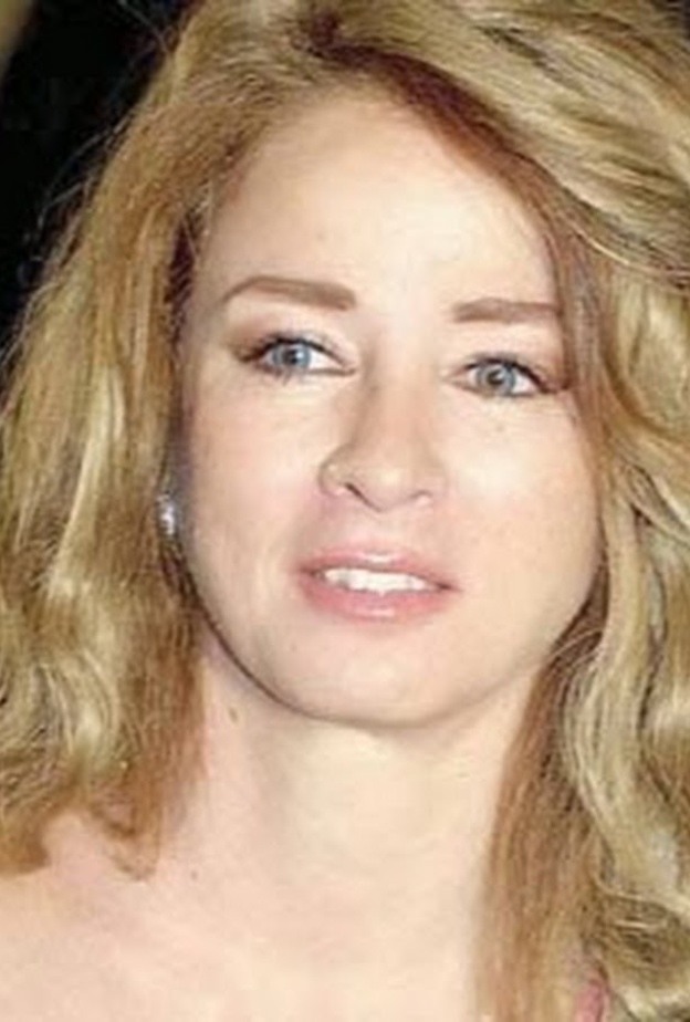 نجلاء فتحي تعانى من الصدفية والتهاب الكبد