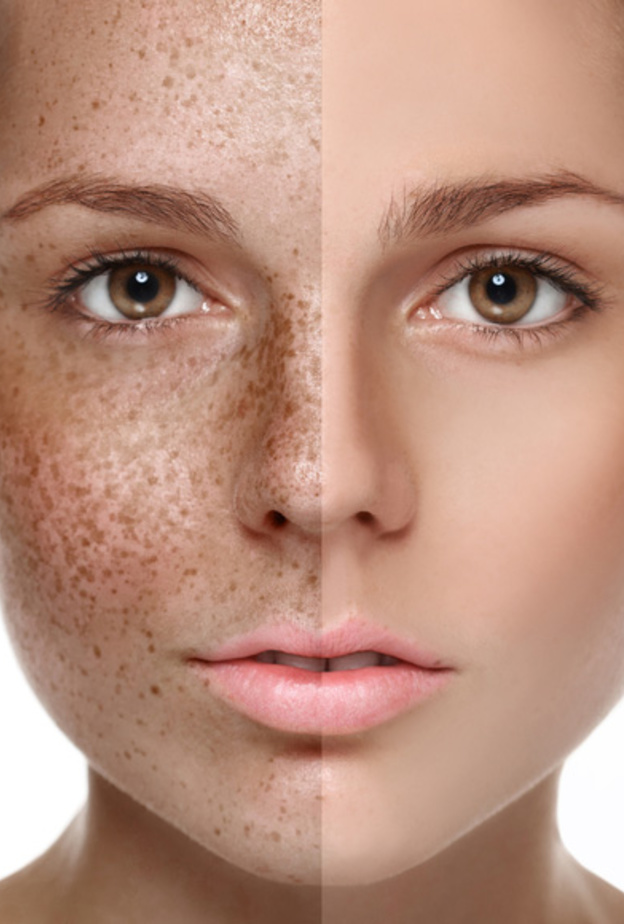 ملعقة من العسل مع الطحينة تعمل على نقاوة بشرتك