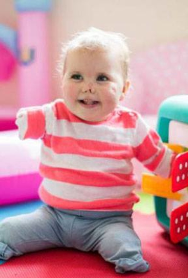 شاهد طفلة لم تكمل عامها الأول فقدت أطرافها الأربعة ولم تفقد ابتسامتها