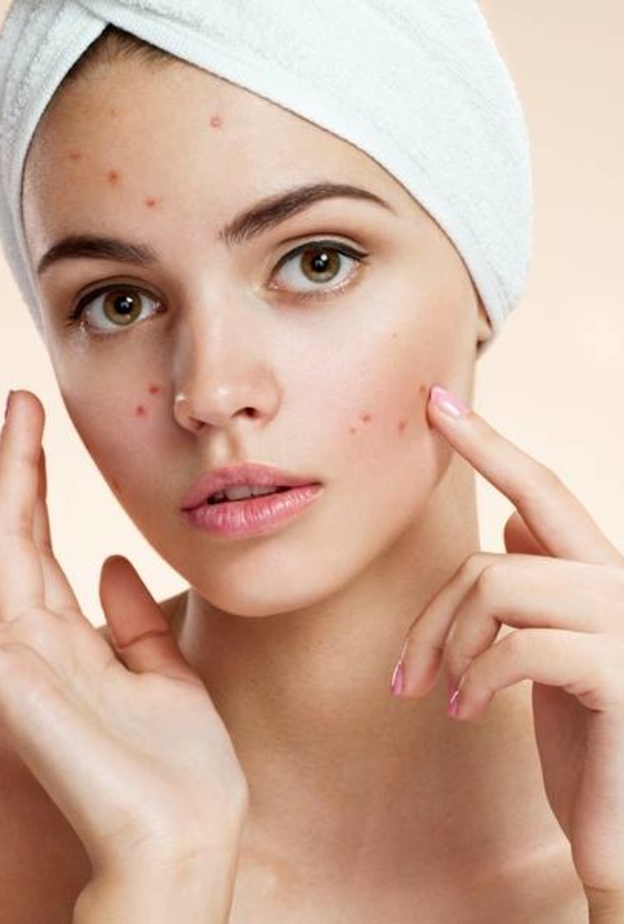 خبراء.. حب الشباب يسبب السرطان 