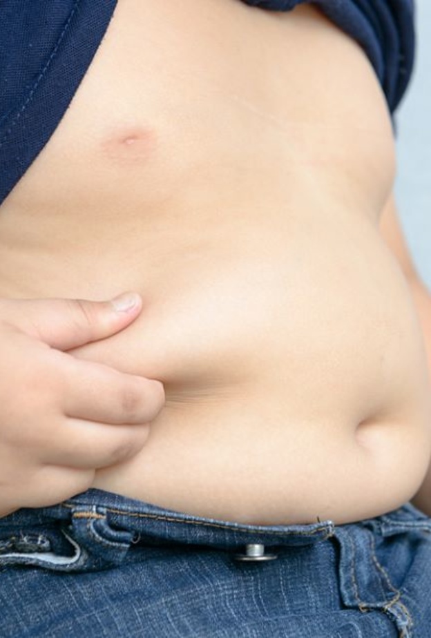 المضادات الحيوية وراء سمنة الأطفال في الكِبر