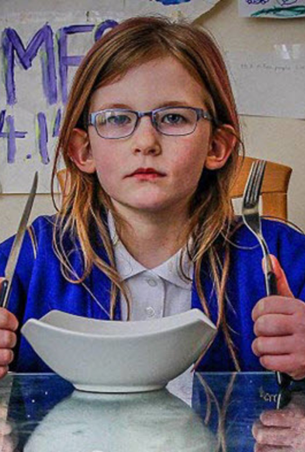 الطفلة أوليفيا تعاني من نقص الكرموزوم رقم 6