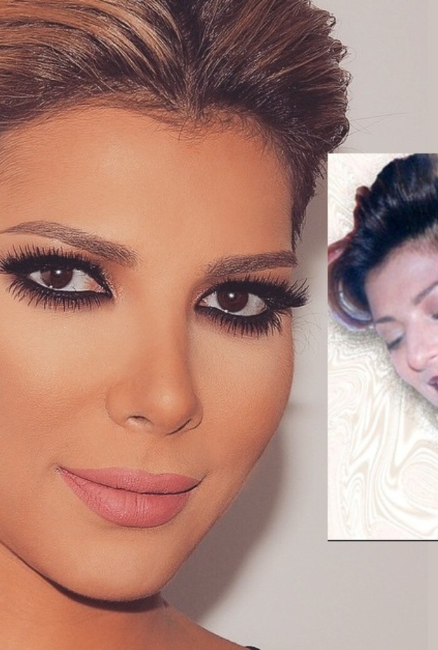 الفنانة السورية اصالة قبل وبعد تجميل الانف
