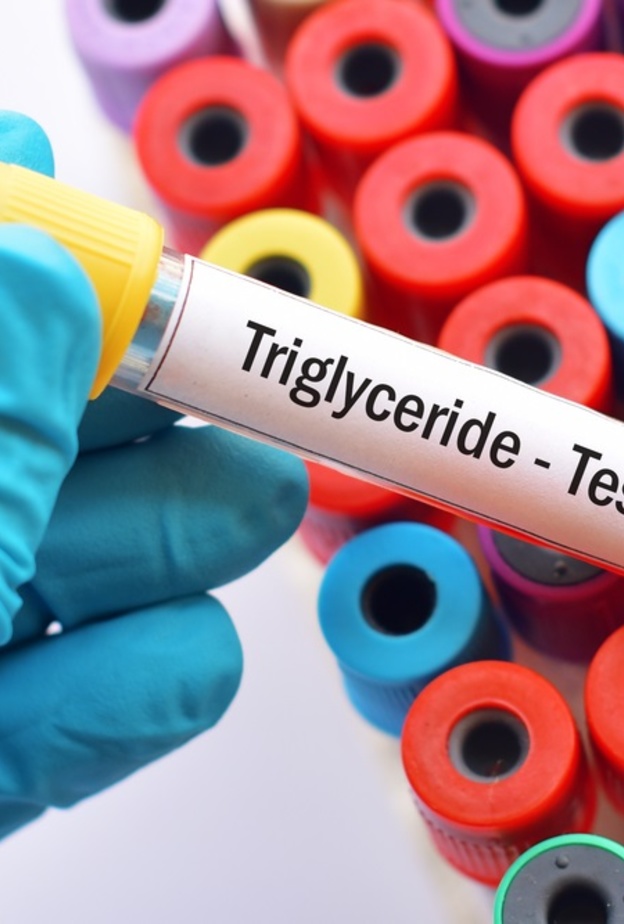 ما هي أعراض ارتفاع الدهون الثلاثية وكيف يمكن للمريض تقليلها