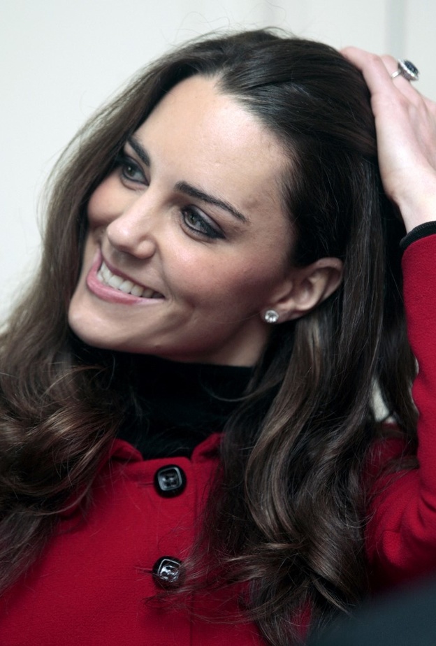 ندبة كبيرة على وجه كيت ميدلتون.. فما قصتها؟