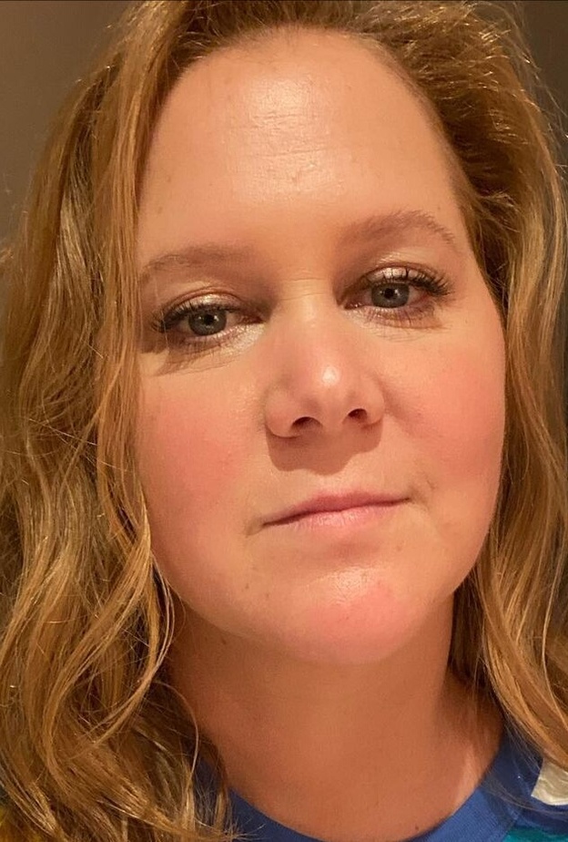 تفاصيل الحالة الصحية لـ"إيمي شومر" بعد خضوعها لعملية جراحية