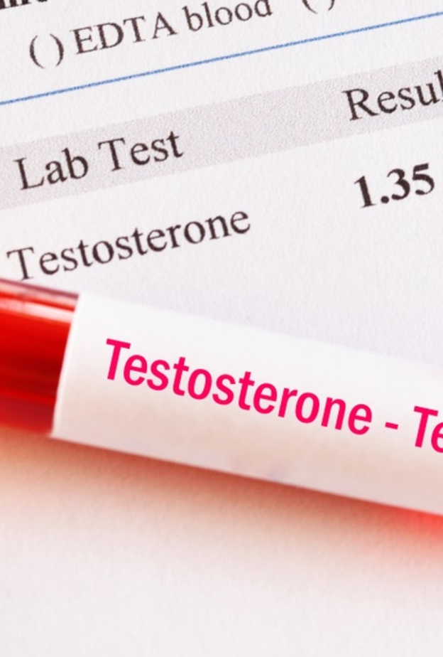 ما هي أعراض ارتفاع هرمون التستوستيرون عند النساء