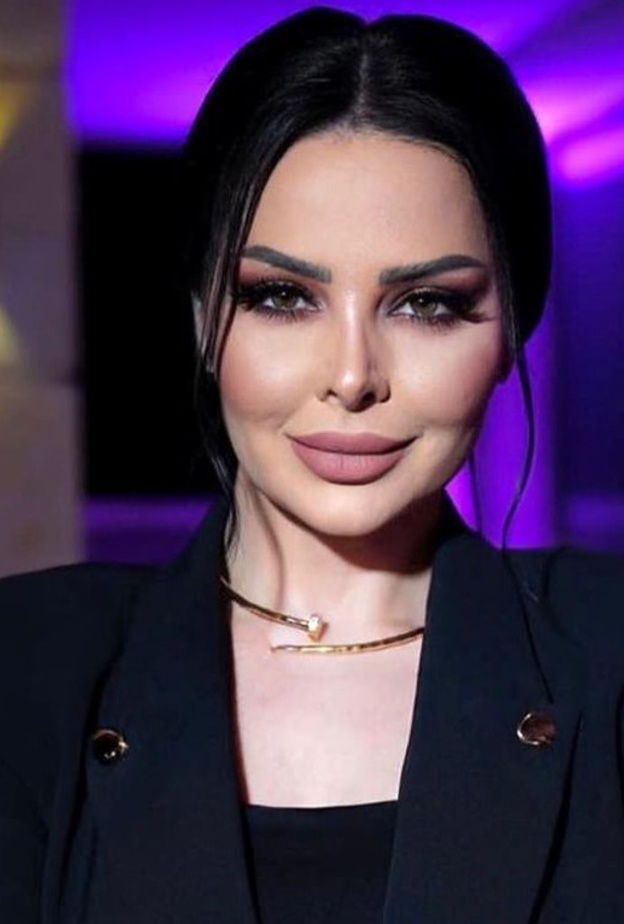 ديانا كرزون