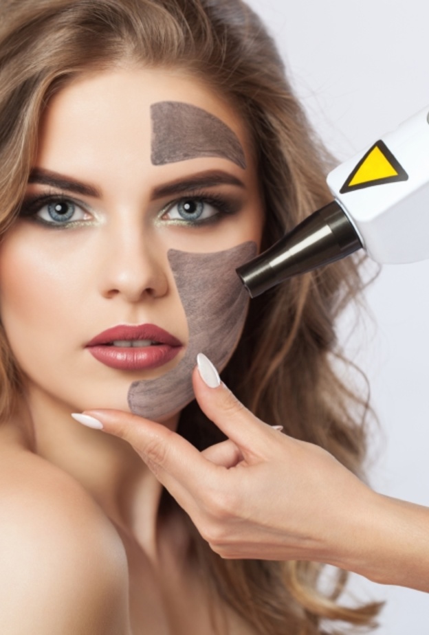 الليزر الكربوني للبشرة هو علاج مبتكر لإعادة تسطيح البشرة